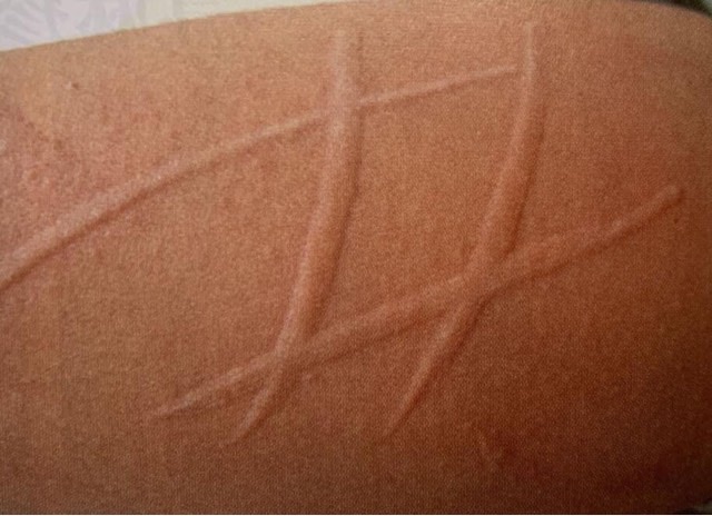 网络配图 网络配图