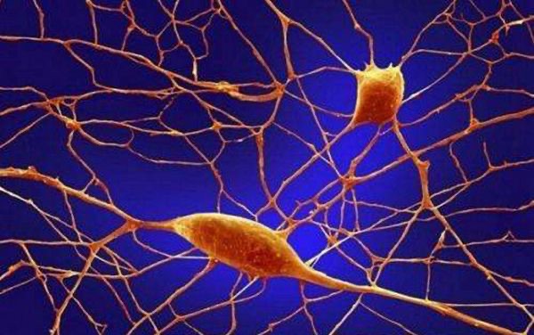 网络图片(侵删) 网络图片(侵删)