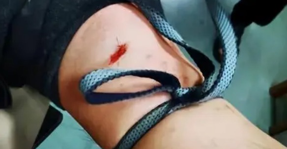 网络图片(侵删) 网络图片(侵删)