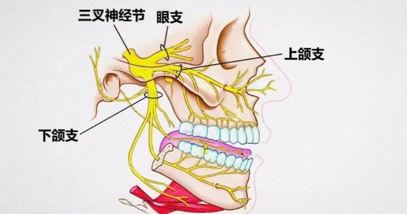 网络配图 网络配图